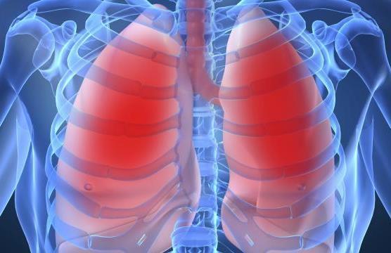 Asbestose: Distúrbios Pulmonares e das Vias Respiratórias 